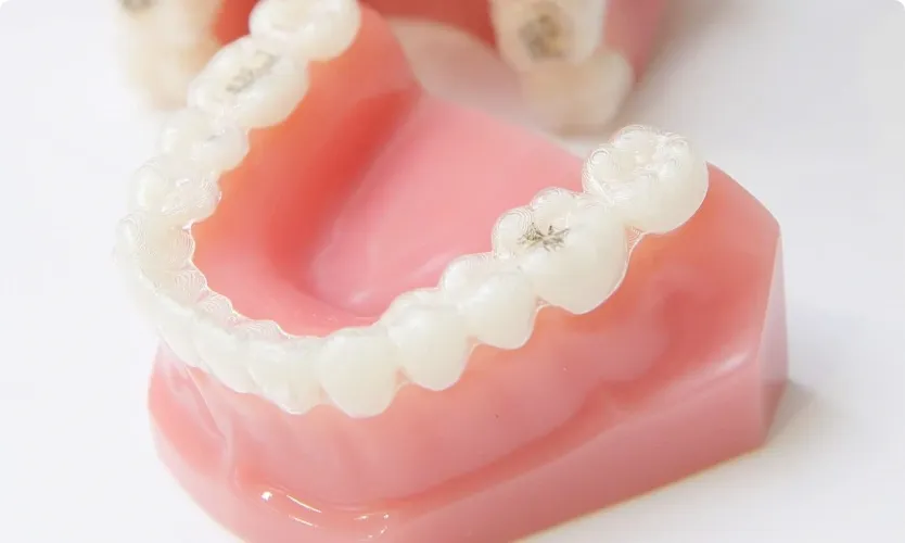 マウスピース矯正